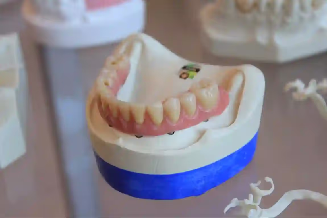 dentaltransplantcost.club